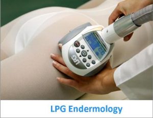 LPG Endermology