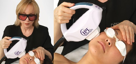 Laser Treatments