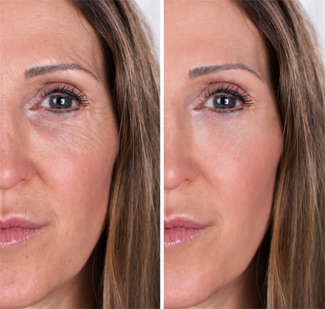 institut dermed retinol peel and serum