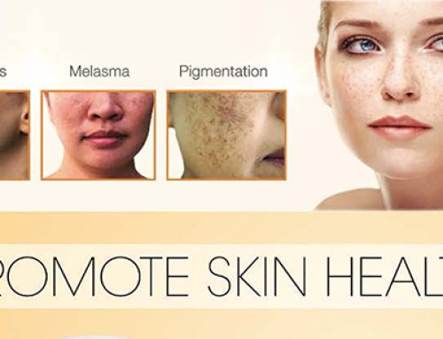 The Importance of Skin Health